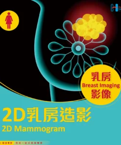 2D乳房造影