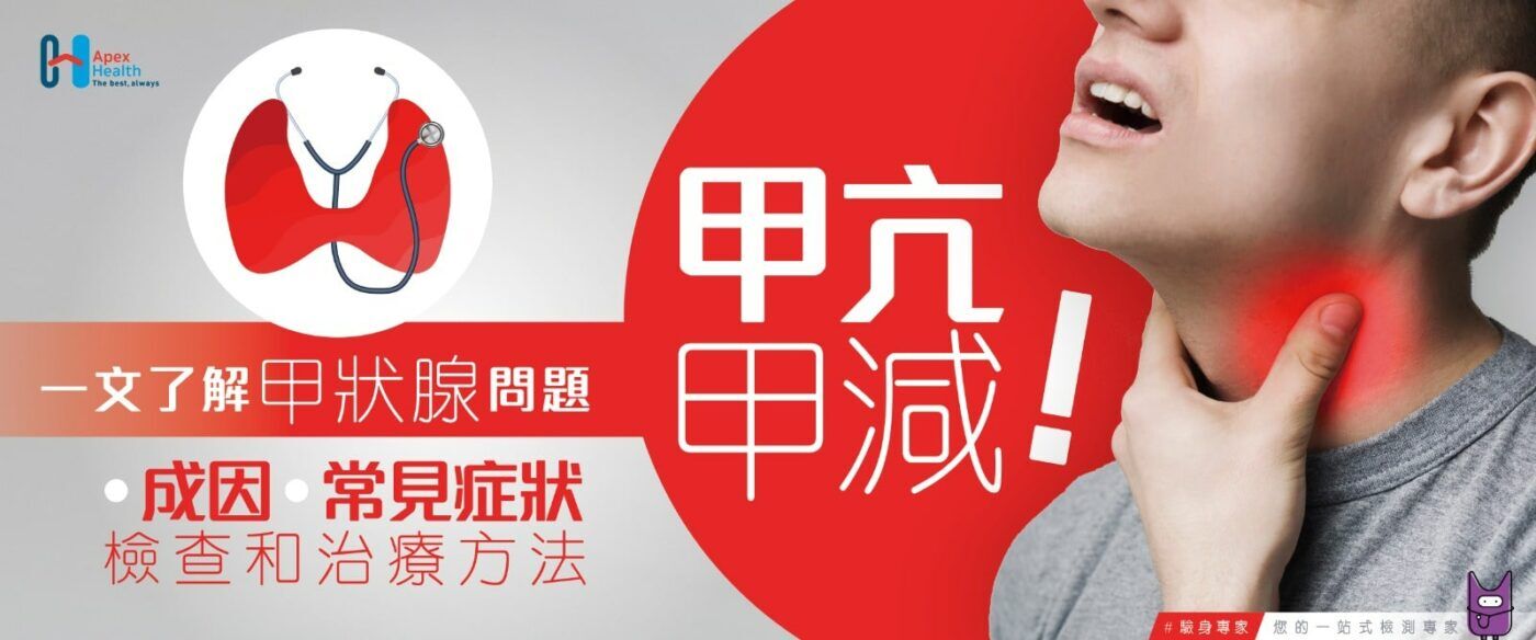 傲士甲狀腺檢查方法 1600x667-min